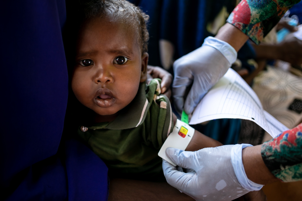 <p><sub>Somalia: A child has its mid-upper arm circumference measured to gauge for evidence of malnutrition, at Dolow Health Centre, on 3 February 2022. UNICEF continues their life-saving assistance through drought-affected areas, working with families, local communities, organizations and governments throughout Somalia.</sub></p> <p><sub>Somalia: A child has its mid-upper arm circumference measured to gauge for evidence of malnutrition, at Dolow Health Centre, on 3 February 2022. UNICEF continues their life-saving assistance through drought-affected areas, working with families, local communities, organizations and governments throughout Somalia.</sub></p>